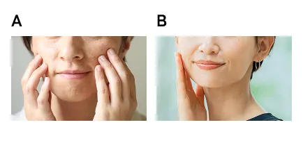 女性の比較写真